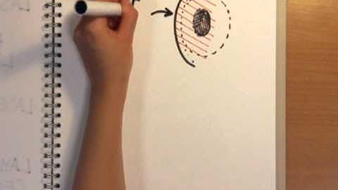 How Does Laser Eye Surgery Work? - Naked Science Scrapbook