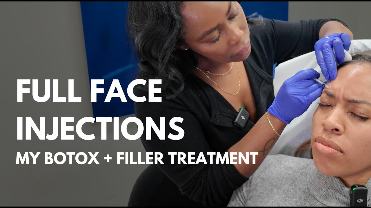 Ботокс и филлеры: вот что произошло и чему я научился