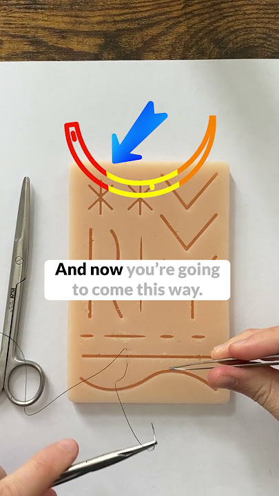 How to do the horizontal mattress suture like a plastic surgeon!