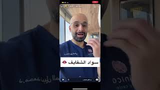 سبب سواد الشفايف/الدكتور محمد نبيل الصفي