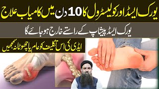 How To Reduce Uric Acid Pain | Uric Acid Treatment | Uric Acid  Ka Ilaj  | Dr Sharafat Ali