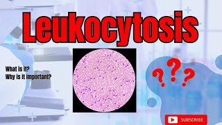 Leukocytosis - Elevated White Blood Cell Count - An Overview