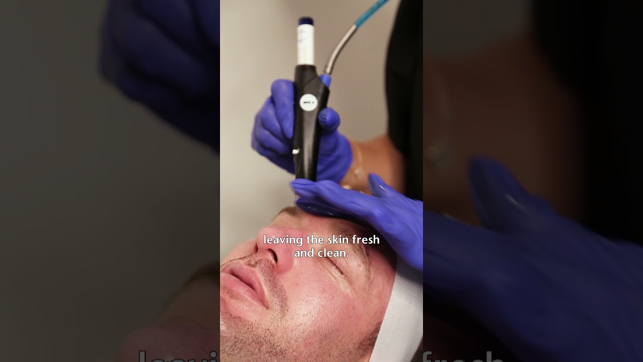 Men Skin care | Hydrafacial Skin Treatment in Sydney | Chad Hurst