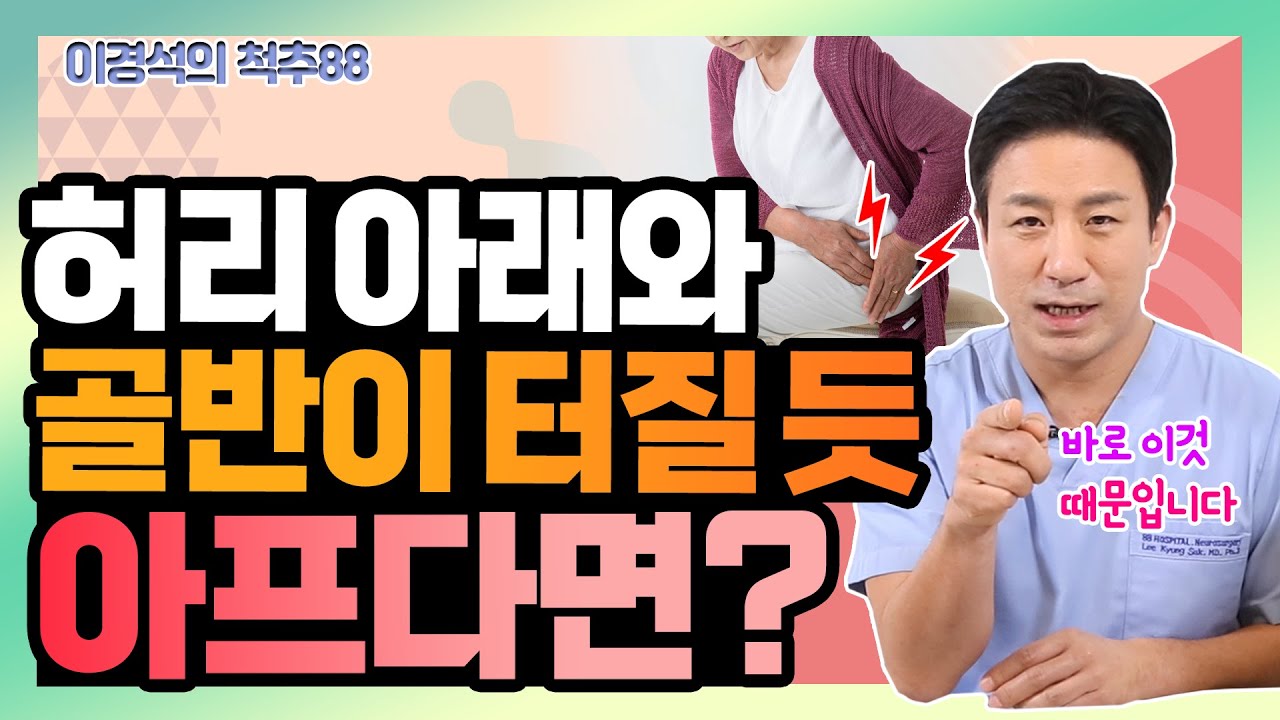 이상근 증후군처럼 헷갈리기 쉬운 '장요근 증후군' - 이경석의 척추88 #74