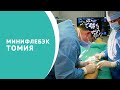 Минифлебэктомия