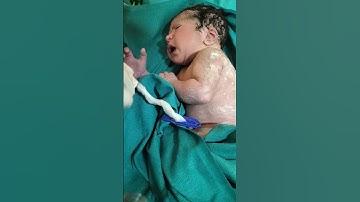 Thumbnail of New born baby just after birth umbilical cord cutting with me #birthmoment #cutebaby #babyshorts