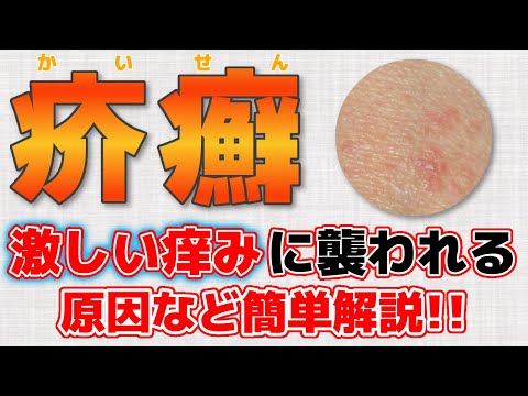 疥癬の種類、症状など簡単にお話しします！