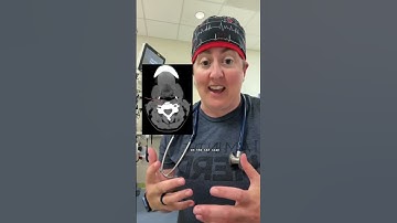 One of my most interesting cases has a lesson that could save your life! #case #medicine #hospital