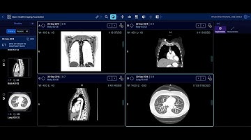 OHIF Viewer:  A React Case Study