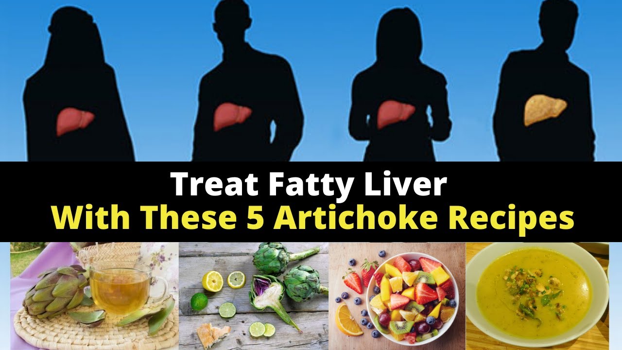 Treat Your Fatty Liver With These 5 Artichoke Recipes Easy YouTube