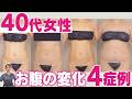 【脂肪吸引】40代の落ちない浮き輪肉どう変わる？症例写真でBMI・体型が違う4人の変化を解説！｜脂肪吸引の母#269