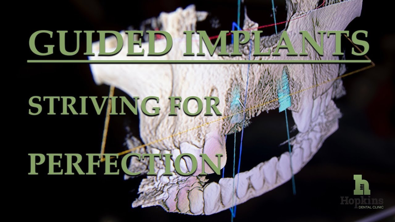 Advanced technology allows precise implant placement.