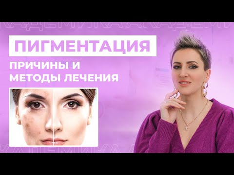 Как избавиться от пигментации на лице? Причины появления и методы лечения пигментных пятен