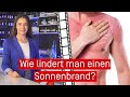 Wie lindert man einen Sonnenbrand?
