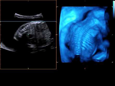 Medison Sonoace X8 Manual Arts