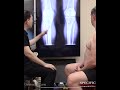 X Ray Exam Reveals Hidden Cause of Golf Knee Pain Shorts Part 1