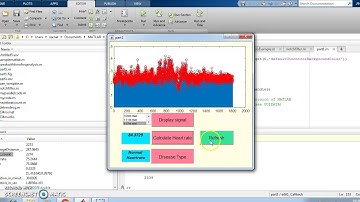 Heart beat detection using arrhythmia signal from mit bih database