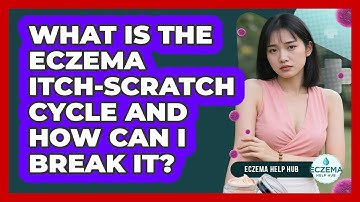 What Is The Eczema Itch-scratch Cycle And How Can I Break It? - Eczema Help Hub