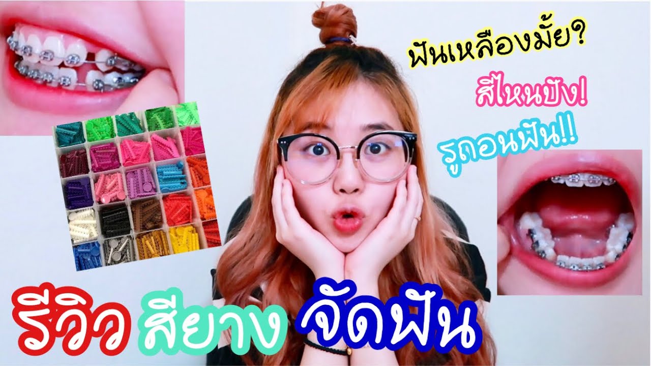 สี ยาง ฟัน สวย ๆ  Update New  รีวิวสียางจัดฟันEP.16สียางอันไหนรอด..+ไม่รอด+อัปเดตเดือน6?❤️