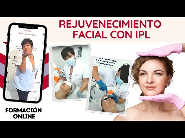 Rejuvenecimiento Facial: Luz Pulsada IPL- Oftalvist