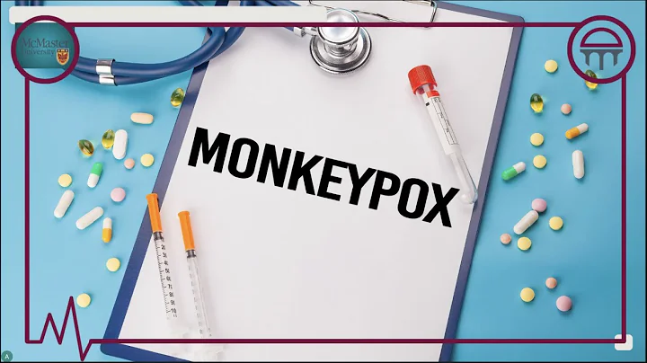 Monkeypox Virus – Explained