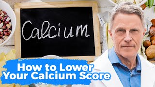 How To Lower Your Calcium Score Part 1 Root Causes Vitamin D