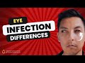 DON T PANIC How To Distinguish Conjunctivitis Pink Eye And Eye Infections In 2024