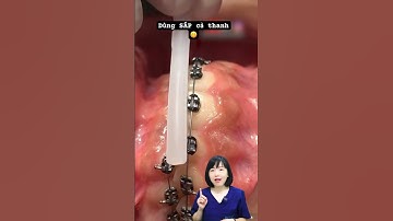 Dùng sáp nha khoa khi niềng răng | Dr Anh Thư