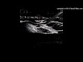 [free] che + rest in bass type beat - "conflict"
