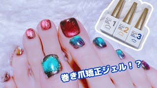 マイフットに巻き爪矯正ジェル使ってみます