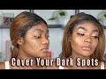 How to cover dark spots and scars with makeup