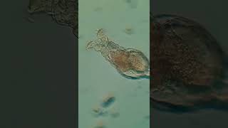 What lives in my local park? 🌳🔬 #microcosmos #microscope #microcosm #microscopy Lucas Co Property Values Under The Microscope