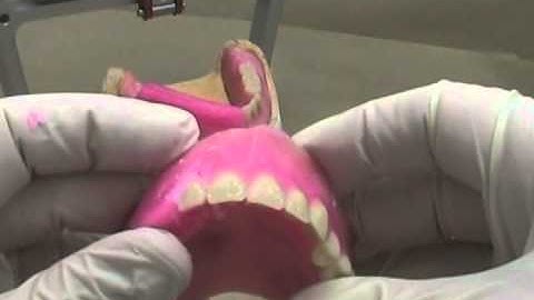 31 Setting Denture Teeth - Maxillary Anteriors