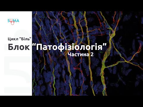 Цикл «Біль» | блок «Патофізіологія» част ІІ POLYMATHES