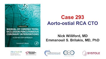 Case 293: Manual of CTO PCI - Flush aorto-ostial RCA CTO