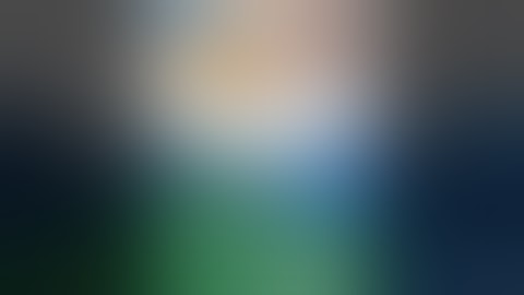 Vỡ Túi Ngực và Co Thắt Bao Xơ Độ 4 Sau 20 Năm Nâng Ngực