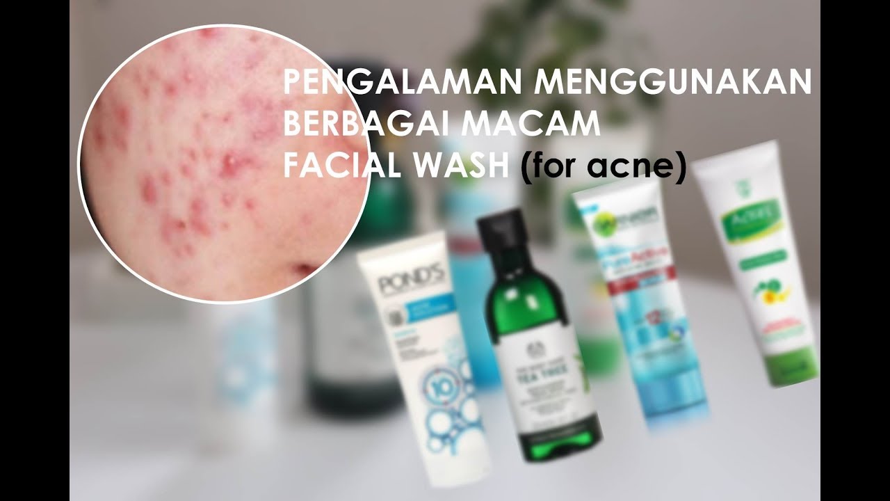 facial wash untuk acne prone skin
