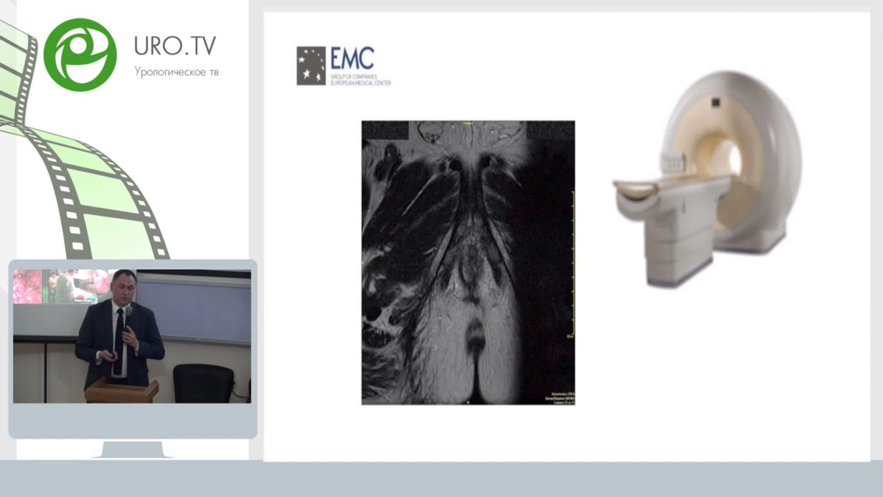 Абдуллин И И - Фьюжн биопсия простаты, первый опыт - YouTube