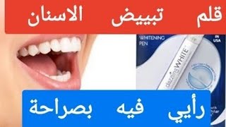 قلم تبييض الاسنان ?رأيي فيه بصرااااحة  زعما مليييح ?ونصائح للتبييض تابعوا الفيديو معايا 