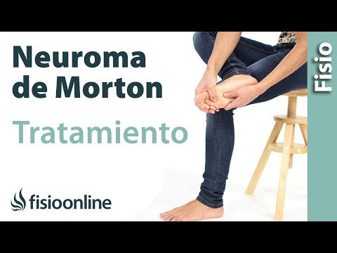 Neuroma de Morton. Tatamiento con ejercicios, auto-masajes y estiramientos