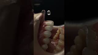 #dentalphotography #photography #macroshot #cosmeticdentistry #odontologia #dentalphotography #photography #macroshot #cosmeticdentistry #odontologia