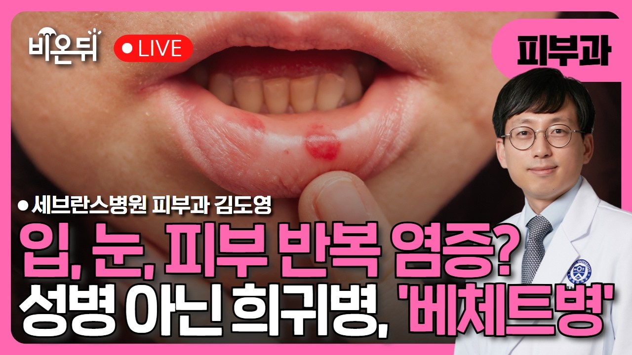 입, 눈, 피부 반복 염증?성병 아닌 희귀병, 베체트병 / 세브란스병원 피부과 김도영