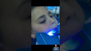 إزالة حشو البلاتين واستبدالة بحشو كمبوزيت||replacing a silver filling