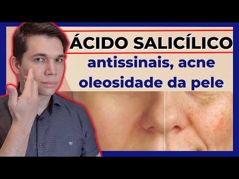 Vídeo: 4 maneiras de usar ácido salicílico