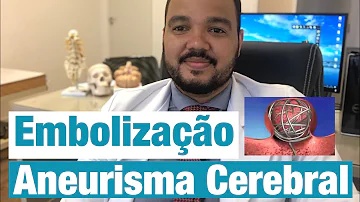 Quais os riscos da embolização de aneurisma cerebral?