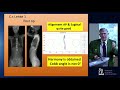 Biomechanical Impact of Global Spinal Balance - Jean E. Dubousset, MD