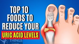 How to lower Uric Acid | 10 Expert Tips on How to Fight Gout Attack | Foods to Reduce URIC ACID 10 Expert Tips On How To Fight Gout Attack