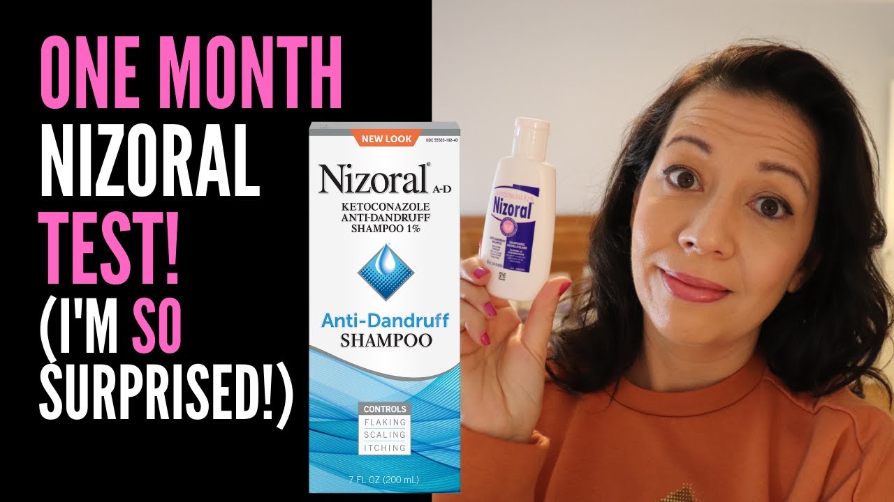 HAIR LOSS SUFFERER REVIEWS NIZORAL SHAMPOO: One Month Review On 2%  Ketoconazole I'M VERY SURPRISED! - YouTube
