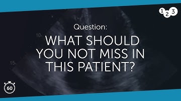 60 Seconds of Echo Teaching Question: What should you NOT miss in this patient?