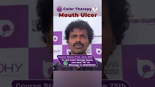 Color Therapy For Mouth Ulcers Dr.basavaraj K
